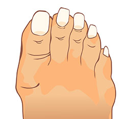 Tired Sole - Foot Care Clinic in Ottawa and Mobile Foot Care (In-Home)